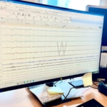 Analyse des données d’un examen du sommeil au Centre d’explorations du sommeil du CH La Chartreuse. Analyse des données d’un examen du sommeil au Centre d’explorations du sommeil du CH La Chartreuse.